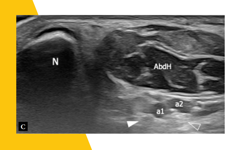 3. Musculatura intrinseca pie ecografia tempo formacion.png